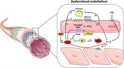 Resveratrol and vascular health: evidence from clinical studies and mechanisms of actions related to its metabolites produced by gut microbiota